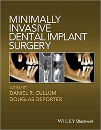 تاب الکترونیکی جراحی ایمپلنت دندان با حداقل تهاجمMinimally Invasive Dental Implant Surgery 1ED