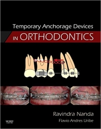 دانلود رایگان کتاب دستگاه انکوریج موقت در ارتودنسی Temporary Anchorage Devices in Orthodontics-1ED