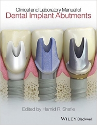 دانلود کتاب ایمپلنت اباتمنت Clinical and Laboratory Manual of Dental Implant Abutments 1 ED