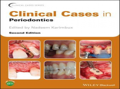 دانلود کتاب کیس های پریودانتیکس Clinical Cases in Periodontics 2nd Edition (Clinical Cases (Dentistry)) ویرایش دوم - 2022