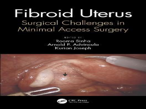 دانلود کتاب فیبروم رحم Fibroid Uterus: Surgical Challenges in Minimal Access Surgery 1st Edition