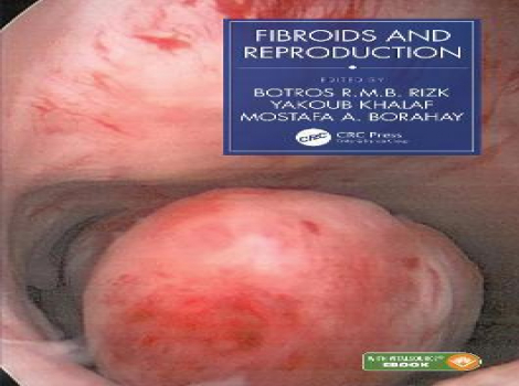 دانلود کتاب فیبروم Fibroids and Reproduction 1st Edition