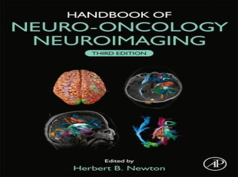 دانلود کتاب تصویربرداری نورو-انکولوژی Handbook of Neuro-Oncology Neuroimaging 3rd Edition