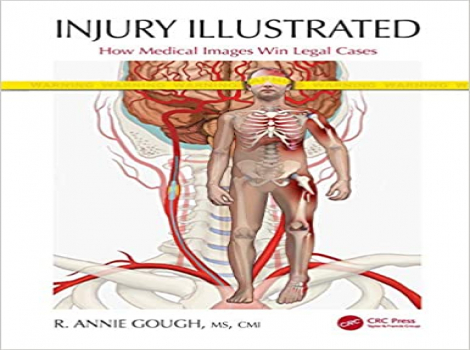 دانلود کتاب Injury Illustrated: How Medical Images Win Legal Cases 1st Edition