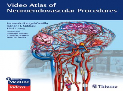 دانلود کتاب اطلس ویدئویی رویه های نوروآندوواسکولار Video Atlas of Neuroendovascular Procedures