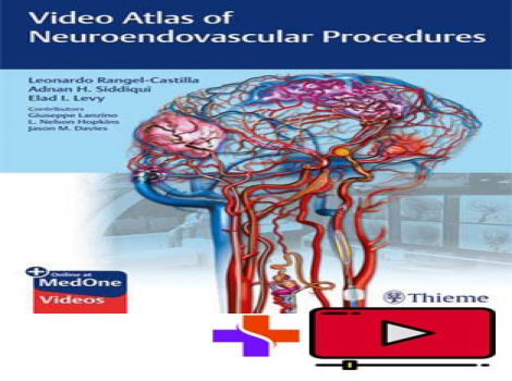 دانلود کتاب اطلس ویدئویی رویه های نوروآندوواسکولار Video Atlas of Neuroendovascular Procedures به همراه ویدئو