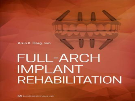 دانلود کتاب ایمپلنت Full-Arch Implant Rehabilitation