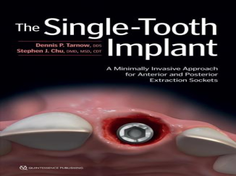 دانلود کتاب ایمپلنت تک دندانی The Single-Tooth Implant: A Minimally Invasive Approach for Anterior and Posterior Extraction Sockets
