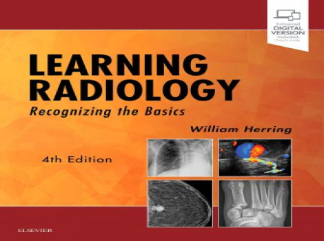 دانلود کتاب یادگیری رادیولوژی شناخت مبانی Learning Radiology: Recognizing the Basics 4th Edition