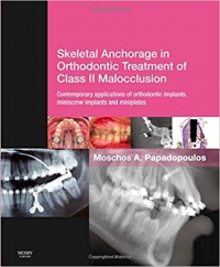 کتاب الکترونیکی درمان کلوژن کلاس2 اسکلتی انکوریج Skeletal Anchorage in Orthodontic Treatment