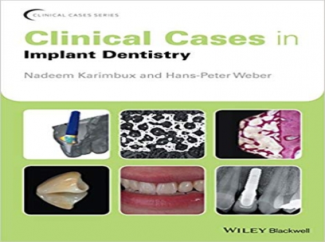 دانلود کتاب کیس‌های بالینی در دندانپزشکی ایمپلنت 2017 Clinical Cases in Implant Dentistry 1 ED ویرایش اول 2017