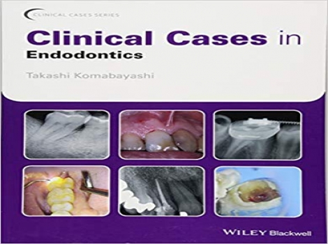 دانلود کتاب کیس‌های بالینی در اندودانتیکس ۲۰۱۸ Clinical Cases in Endodontics 1 ED ویرایش اول 2018