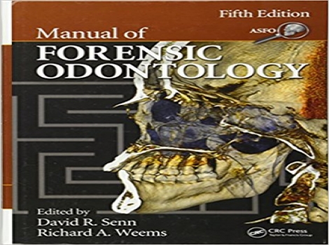 دانلود کتاب راهنمای دندانپزشکی قانونی Manual of Forensic Odontology 5 ED