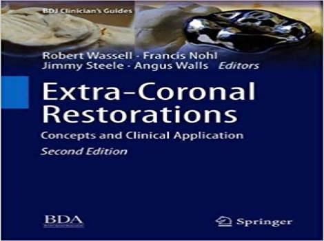 دانلود کتاب ترمیم های فوق کرونال – مفاهیم و کاربرد بالینی Extra-Coronal Restorations: Concepts and Clinical Application 2 ED 2019