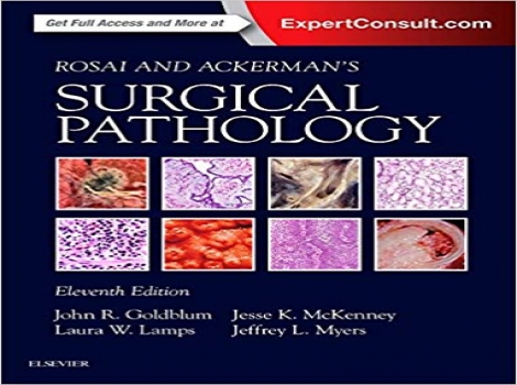 دانلود کتاب پاتولوژی جراحی روسای و اکرمن (۲ جلدی، ۲۰۱۸) Rosai and Ackerman's Surgical Pathology - 2 Vol 11 ED