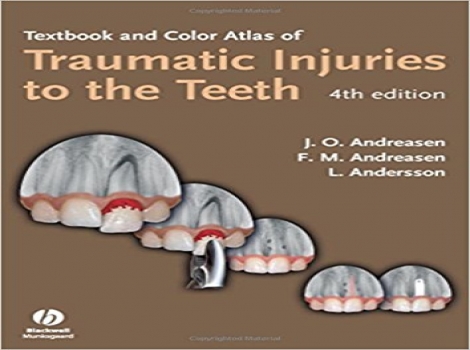 Textbook and Color Atlas of Traumatic Injuries to the Teeth 4