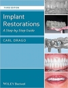 کتاب الکترونیکی ترمیم ایمپلنت Implant Restorations: A Step-by-Step Guide 3ED