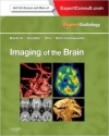 دانلود کتاب تصویر برداری از مغز(سری کارشناس رادیولوژی) Imaging of the Brain: Expert Radiology Series, 1 ED
