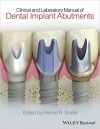 کتاب الکترونیکی ایمپلنت اباتمنت Clinical and Laboratory Manual of Dental Implant Abutments 1 ED