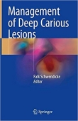 دانلود کتاب مدیریت ضایعات کرم خوردگی عمقی Management of Deep Carious Lesions